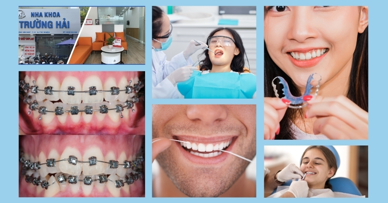 10 điều cần lưu ý trước và sau khi niềng răng