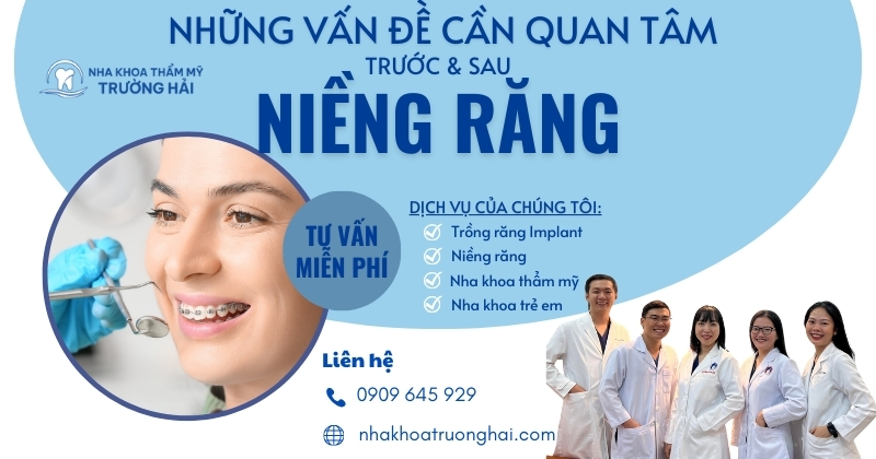 Những vấn đề cần quan tâm trước và sau khi niềng răng