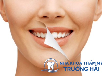Dịch vụ nha khoa thẩm mỹ