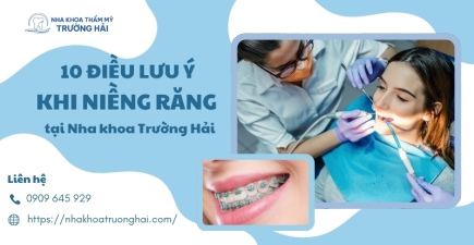 10 Điều cần lưu ý gì trước và sau khi niềng răng?