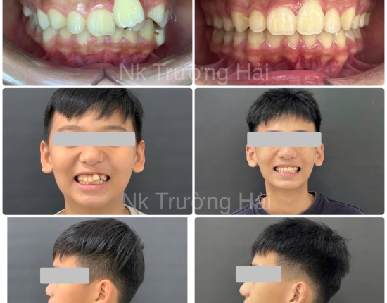 Hình 7